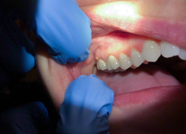 Best Emergency Cosmetic Dentistry in Suamico, WI